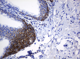 NDUFB10 Antibody - IHC of paraffin-embedded Human prostate tissue using anti-NDUFB10 mouse monoclonal antibody.