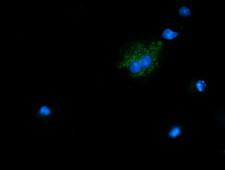 NDUFB10 Antibody - Anti-NDUFB10 mouse monoclonal antibody immunofluorescent staining of COS7 cells transiently transfected by pCMV6-ENTRY NDUFB10.