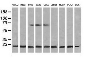 NDUFB10 Antibody - Western blot of extracts (35 ug) from 9 different cell lines by using g anti-NDUFB10 monoclonal antibody (HepG2: human; HeLa: human; SVT2: mouse; A549: human; COS7: monkey; Jurkat: human; MDCK: canine; PC12: rat; MCF7: human).