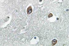 NDUFB10 Antibody - IHC of NDUFB10 (E95) pAb in paraffin-embedded human brain tissue.