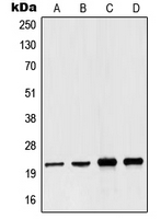 NDUFB10 Antibody - Western blot analysis of NDUFB10 expression in Jurkat (A); A431 (B); Raji (C); HepG2 (D) whole cell lysates.