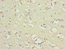 NDUFB10 Antibody - Immunohistochemistry of paraffin-embedded human brain tissue at dilution of 1:100