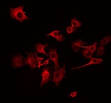 NDUFB10 Antibody - Staining COLO205 cells by IF/ICC. The samples were fixed with PFA and permeabilized in 0.1% Triton X-100, then blocked in 10% serum for 45 min at 25°C. The primary antibody was diluted at 1:200 and incubated with the sample for 1 hour at 37°C. An Alexa Fluor 594 conjugated goat anti-rabbit IgG (H+L) Ab, diluted at 1/600, was used as the secondary antibody.