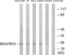NDUFB10 Antibody - Western blot analysis of extracts from COLO cells, Jurkat cells, HeLa cells, HepG2 cells and HUVEC cells, using NDUFB10 antibody.