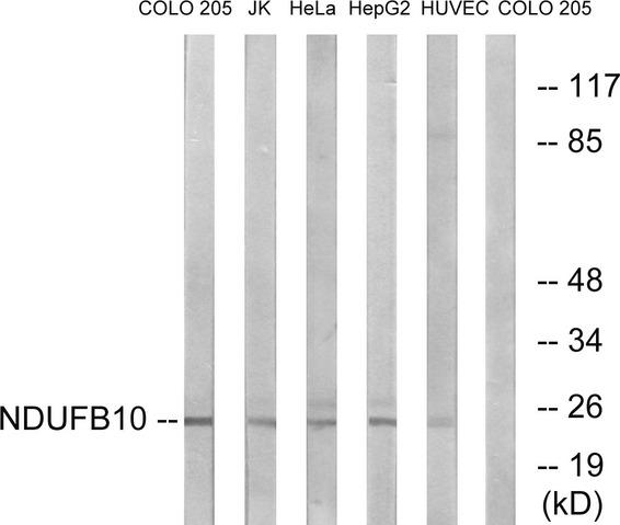 NDUFB10 Antibody - Western blot analysis of extracts from COLO cells, Jurkat cells, HeLa cells, HepG2 cells and HUVEC cells, using NDUFB10 antibody.
