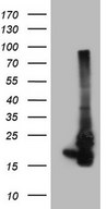 NDUFB11 Antibody - HEK293T cells were transfected with the pCMV6-ENTRY control. (Left lane) or pCMV6-ENTRY NDUFB11. (Right lane) cDNA for 48 hrs and lysed. Equivalent amounts of cell lysates. (5 ug per lane) were separated by SDS-PAGE and immunoblotted with anti-NDUFB11. (1:2000)