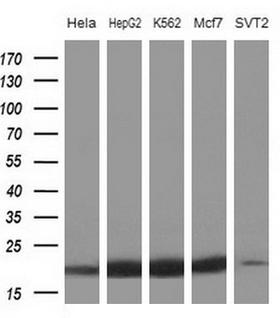 NDUFB11 Antibody - Western blot of extracts (10ug) from 5 different cell lines by using anti-NDUFB11 monoclonal antibody at 1:200 dilution.