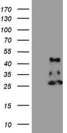 NDUFB11 Antibody - HEK293T cells were transfected with the pCMV6-ENTRY control. (Left lane) or pCMV6-ENTRY NDUFB11. (Right lane) cDNA for 48 hrs and lysed. Equivalent amounts of cell lysates. (5 ug per lane) were separated by SDS-PAGE and immunoblotted with anti-NDUFB11.