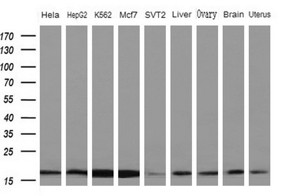 NDUFB11 Antibody - Western blot analysis of extracts. (10ug) from 5 different cell lines and 4 human tissue by using anti-NDUFB11 monoclonal antibody. (1: Hela; 2: HepG2; 3: K562; 4: Mcf7; 5: SVT2; 6: Liver; 7: Testis; 8: Brain; 9: Uterus) at 1:200 dilution.