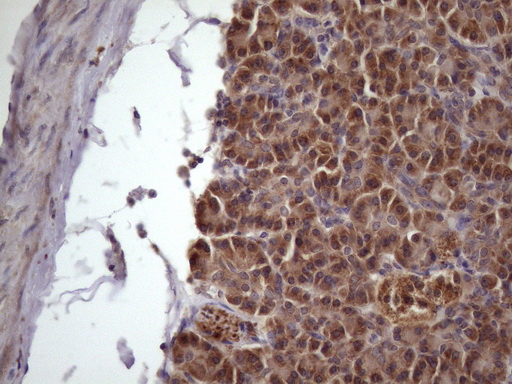 NDUFB11 Antibody - Immunohistochemical staining of paraffin-embedded Human pancreas tissue within the normal limits using anti-NDUFB11 mouse monoclonal antibody. (Heat-induced epitope retrieval by 1 mM EDTA in 10mM Tris, pH8.5, 120C for 3min. (1:150)