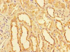 NDUFB11 Antibody - Immunohistochemistry of paraffin-embedded human kidney tissue using NDUFB11 Antibody at dilution of 1:100
