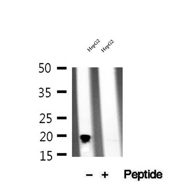 NDUFB11 Antibody - Western blot analysis of extracts of HepG2 cells using NDUFB11 antibody.