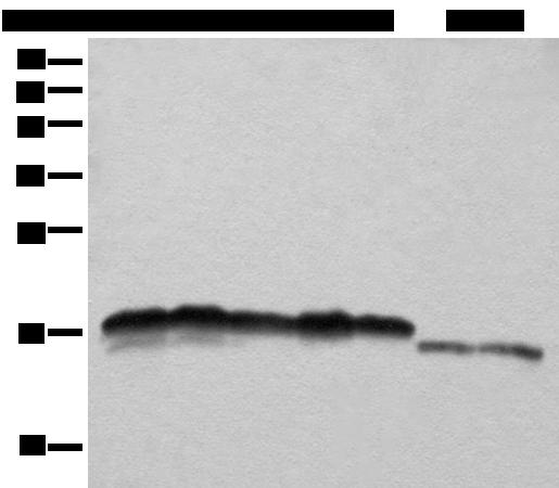 NDUFB11 Antibody - Western blot analysis of Hela HEPG2 A431 K562 and 231 cell Mouse liver tissue and Mouse brain tissue lysates  using NDUFB11 Polyclonal Antibody at dilution of 1:1000