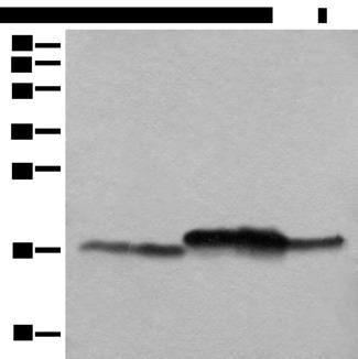 NDUFB11 Antibody - Western blot analysis of Mouse brain tissue Mouse liver tissue 231 cell K562 cell A431 cell lysates  using NDUFB11 Polyclonal Antibody at dilution of 1:1000