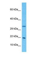 NDUFB11 Antibody - Western blot of NDUFB11 Antibody with human HeLa Whole Cell lysate.  This image was taken for the unconjugated form of this product. Other forms have not been tested.
