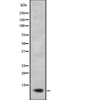 NDUFB2 Antibody - Western blot analysis of NDUFB2 expression in A673 lysate. The lane on the left is treated with the antigen-specific peptide.