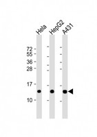 NDUFB3 Antibody - All lanes: Anti-NDUFB3 Antibody (N-Term) at 1:2000 dilution. Lane 1: HeLa whole cell lysate. Lane 2: HepG2 whole cell lysate. Lane 3: A431 whole cell lysate Lysates/proteins at 20 ug per lane. Secondary Goat Anti-Rabbit IgG, (H+L), Peroxidase conjugated at 1:10000 dilution. Predicted band size: 11kDa. Blocking/Dilution buffer: 5% NFDM/TBST.