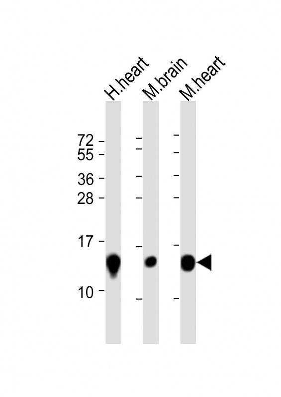 NDUFB3 Antibody - All lanes: Anti-NDUFB3 Antibody (N-Term) at 1:8000 dilution. Lane 1: human heart lysate. Lane 2: mouse brain lysate. Lane 3: mouse heart lysate Lysates/proteins at 20 ug per lane. Secondary Goat Anti-Rabbit IgG, (H+L), Peroxidase conjugated at 1:10000 dilution. Predicted band size: 11 kDa. Blocking/Dilution buffer: 5% NFDM/TBST.