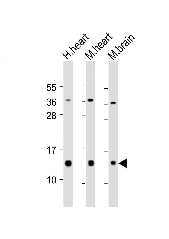 NDUFB3 Antibody - All lanes: Anti-NDUFB3 Antibody (Center) at 1:2000 dilution. Lane 1: human heart lysate. Lane 2: mouse heart lysate. Lane 3: mouse brain lysate Lysates/proteins at 20 ug per lane. Secondary Goat Anti-Rabbit IgG, (H+L), Peroxidase conjugated at 1:10000 dilution. Predicted band size: 11 kDa. Blocking/Dilution buffer: 5% NFDM/TBST.