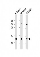 NDUFB3 Antibody - All lanes: Anti-NDUFB3 Antibody (Center) at 1:2000 dilution. Lane 1: human heart lysate. Lane 2: mouse heart lysate. Lane 3: mouse brain lysate Lysates/proteins at 20 ug per lane. Secondary Goat Anti-Rabbit IgG, (H+L), Peroxidase conjugated at 1:10000 dilution. Predicted band size: 11 kDa. Blocking/Dilution buffer: 5% NFDM/TBST.