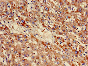 NDUFB3 Antibody - Immunohistochemistry of paraffin-embedded human liver tissue using NDUFB3 Antibody at dilution of 1:100