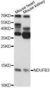 NDUFB3 Antibody - Western blot analysis of extracts of various cell lines, using NDUFB3 antibody at 1:1000 dilution. The secondary antibody used was an HRP Goat Anti-Rabbit IgG (H+L) at 1:10000 dilution. Lysates were loaded 25ug per lane and 3% nonfat dry milk in TBST was used for blocking. An ECL Kit was used for detection and the exposure time was 10s.