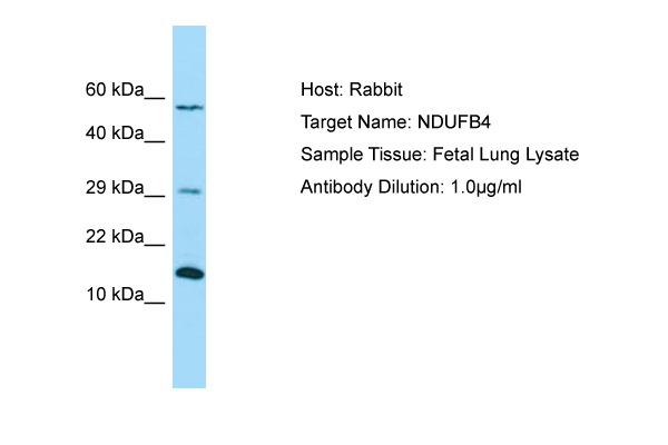 NDUFB4 / B15 Antibody -  This image was taken for the unconjugated form of this product. Other forms have not been tested.