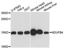 NDUFB4 / B15 Antibody - Western blot analysis of extracts of various cell lines, using NDUFB4 antibody at 1:3000 dilution. The secondary antibody used was an HRP Goat Anti-Rabbit IgG (H+L) at 1:10000 dilution. Lysates were loaded 25ug per lane and 3% nonfat dry milk in TBST was used for blocking. An ECL Kit was used for detection and the exposure time was 90s.