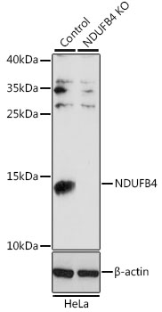 NDUFB4 / B15 Antibody - Western blot analysis of extracts from normal (control) and NDUFB4 knockout (KO) HeLa cells, using NDUFB4 antibody at 1:1000 dilution. The secondary antibody used was an HRP Goat Anti-Rabbit IgG (H+L) at 1:10000 dilution. Lysates were loaded 25ug per lane and 3% nonfat dry milk in TBST was used for blocking. An ECL Kit was used for detection and the exposure time was 30s.