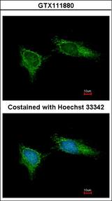 NDUFB5 Antibody - Immunofluorescence of methanol-fixed HeLa using NDUFB5 antibody at 1:200 dilution.