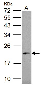 NDUFB5 Antibody - NDUFB5 antibody detects NDUFB5 protein by Western blot analysis. A.30 ug 293T whole cell lysate/extract. 12 % SDS-PAGE. NDUFB5 antibody dilution:1:1000
