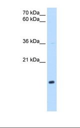 NDUFB5 Antibody - HepG2 cell lysate. Antibody concentration: 1.0 ug/ml. Gel concentration: 15%.  This image was taken for the unconjugated form of this product. Other forms have not been tested.