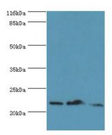 NDUFB5 Antibody - Western blot. All lanes: NDUFB5 antibody at 2 ug/ml. Lane 1: 293T whole cell lysate Lane 2: U251 whole cell lysate Lane 3: mouse liver tissue. Secondary antibody: goat polyclonal to rabbit at 1:10000 dilution. Predicted band size: 22 kDa. Observed band size: 22 kDa.  This image was taken for the unconjugated form of this product. Other forms have not been tested.