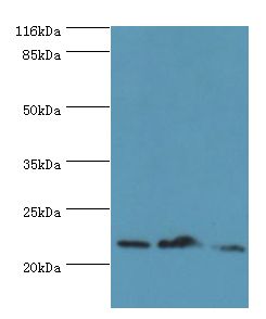 NDUFB5 Antibody - Western blot. All lanes: NDUFB5 antibody at 2 ug/ml. Lane 1: 293T whole cell lysate Lane 2: U251 whole cell lysate Lane 3: mouse liver tissue. Secondary antibody: goat polyclonal to rabbit at 1:10000 dilution. Predicted band size: 22 kDa. Observed band size: 22 kDa.  This image was taken for the unconjugated form of this product. Other forms have not been tested.