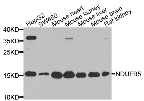 NDUFB5 Antibody - Western blot analysis of extracts of various cell lines.