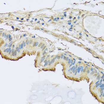NDUFB5 Antibody - Immunohistochemistry of paraffin-embedded human trachea tissue.