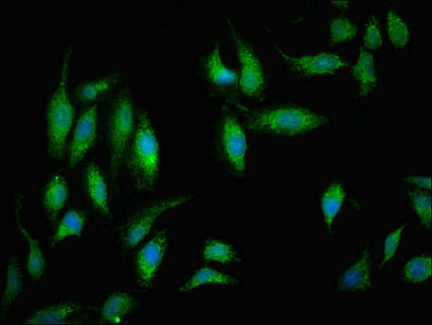 NDUFB5 Antibody - Immunofluorescent analysis of Hela cells diluted at 1:100 and Alexa Fluor 488-congugated AffiniPure Goat Anti-Rabbit IgG(H+L)
