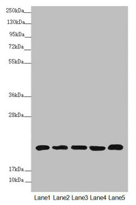 NDUFB5 Antibody - Western blot All Lanes:NDUFB5 antibody at 2.64 ug/ml Lane 1: Mouse heart tissue Lane 2: Mouse kidney tissue Lane 3: 293T whole cell lysate Lane 4: Jurkat whole cell lysate Lane 5: MCF7 whole cell lysate Secondary Goat polyclonal to rabbit IgG at 1/10000 dilution Predicted band size: 22,16 kDa Observed band size: 22 kDa
