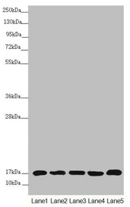 NDUFB5 Antibody - Western blot All lanes: NDUFB5 antibody at 2.64µg/ml Lane 1: Mouse heart tissue Lane 2: Mouse kidney tissue Lane 3: 293T whole cell lysate Lane 4: Jurkat whole cell lysate Lane 5: MCF-7 whole cell lysate Secondary Goat polyclonal to rabbit IgG at 1/10000 dilution Predicted band size: 22, 16 kDa Observed band size: 22 kDa