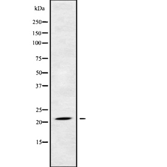 NDUFB5 Antibody - Western blot analysis NDUFB5 using COS7 whole cells lysates