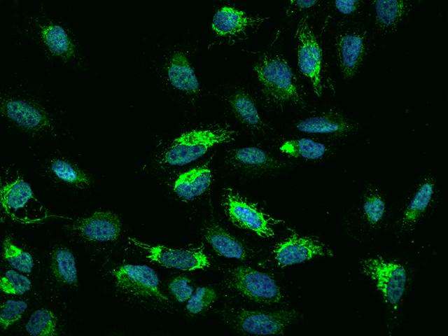 NDUFB5 Antibody - Immunofluorescence staining of NDUFB5 in U2OS cells. Cells were fixed with 4% PFA, permeabilzed with 0.1% Triton X-100 in PBS, blocked with 10% serum, and incubated with rabbit anti-Human NDUFB5 polyclonal antibody (dilution ratio 1:200) at 4°C overnight. Then cells were stained with the Alexa Fluor 488-conjugated Goat Anti-rabbit IgG secondary antibody (green) and counterstained with DAPI (blue). Positive staining was localized to Nucleus and Cytoplasm.