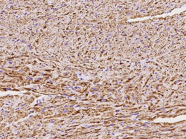 NDUFB5 Antibody - Immunochemical staining of human NDUFB5 in cynomolgus heart with rabbit polyclonal antibody at 1:100 dilution, formalin-fixed paraffin embedded sections.