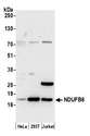 NDUFB6 Antibody - Detection of human NDUFB6 by western blot. Samples: Whole cell lysate (15 µg) from HeLa, HEK293T, and Jurkat cells prepared using NETN lysis buffer. Antibody: Affinity purified rabbit anti-NDUFB6 antibody used for WB at 0.04 µg/ml. Detection: Chemiluminescence with an exposure time of 30 seconds.