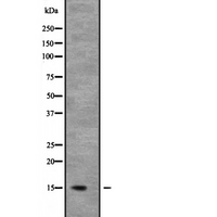 NDUFB6 Antibody - Western blot analysis of NDUFB6 expression in mouse kidney tissue lysate. The lane on the left is treated with the antigen-specific peptide.