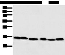 NDUFB6 Antibody - Western blot analysis of 293T Hela PC-3 Lncap and 231 cell Human fetal muscle tissue  using NDUFB6 Polyclonal Antibody at dilution of 1:500