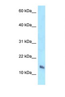 NDUFB7 / B18 Antibody - NDUFB7 antibody Western blot of HCT15 Cell lysate. Antibody concentration 1 ug/ml.  This image was taken for the unconjugated form of this product. Other forms have not been tested.