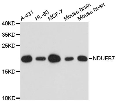NDUFB7 / B18 Antibody - Western blot analysis of extracts of various cell lines, using NDUFB7 antibody at 1:3000 dilution. The secondary antibody used was an HRP Goat Anti-Rabbit IgG (H+L) at 1:10000 dilution. Lysates were loaded 25ug per lane and 3% nonfat dry milk in TBST was used for blocking. An ECL Kit was used for detection and the exposure time was 90s.
