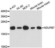 NDUFB7 / B18 Antibody - Western blot analysis of extracts of various cell lines, using NDUFB7 antibody at 1:3000 dilution. The secondary antibody used was an HRP Goat Anti-Rabbit IgG (H+L) at 1:10000 dilution. Lysates were loaded 25ug per lane and 3% nonfat dry milk in TBST was used for blocking. An ECL Kit was used for detection and the exposure time was 90s.