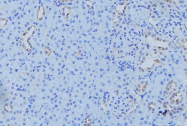 NDUFB7 / B18 Antibody - 1:100 staining mouse kidney tissue by IHC-P. The sample was formaldehyde fixed and a heat mediated antigen retrieval step in citrate buffer was performed. The sample was then blocked and incubated with the antibody for 1.5 hours at 22°C. An HRP conjugated goat anti-rabbit antibody was used as the secondary.