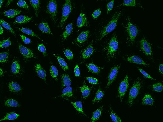 NDUFB7 / B18 Antibody - Immunofluorescence staining of NDUFB7 in HeLa cells. Cells were fixed with 4% PFA, permeabilzed with 0.1% Triton X-100 in PBS, blocked with 10% serum, and incubated with rabbit anti-Human NDUFB7 polyclonal antibody (dilution ratio 1:200) at 4°C overnight. Then cells were stained with the Alexa Fluor 488-conjugated Goat Anti-rabbit IgG secondary antibody (green) and counterstained with DAPI (blue). Positive staining was localized to Cytoplasm.